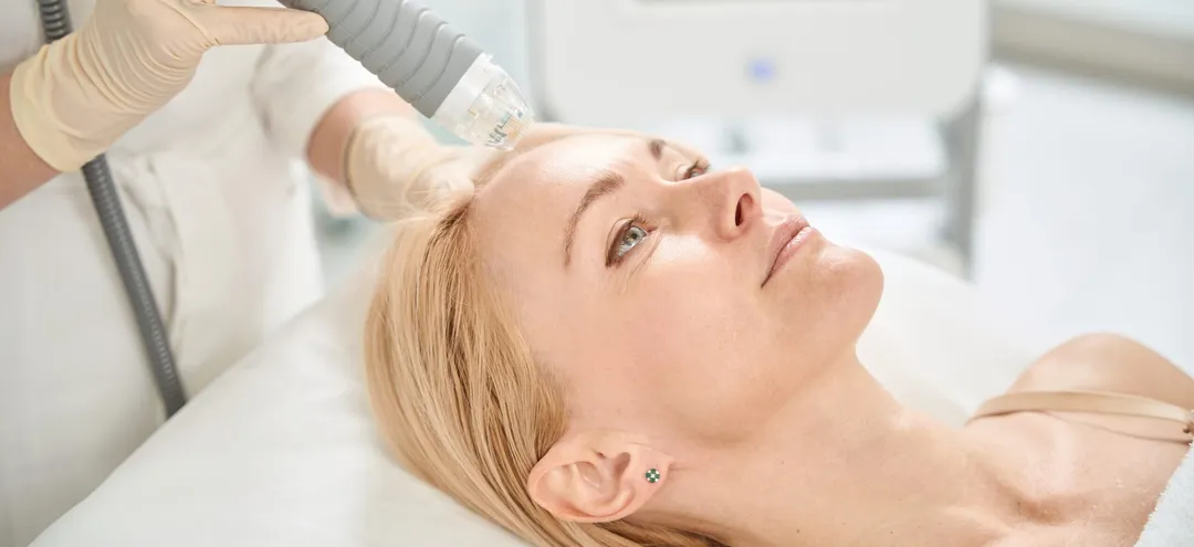 Benefits of Microneedling with PRP - Palm Beach Dermatology Group - Dermatology Clinic - Dermatology Palm Beach - PGA Dermatology Skin & Aesthetics Center - Potenza RF