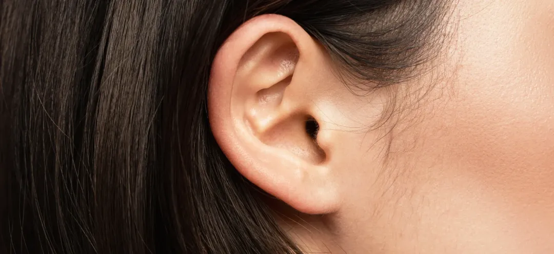 close up view of caucasian female ear - Blackheads in Ear: Causes, Symptoms, Safe Removal, Treatment, and Prevention