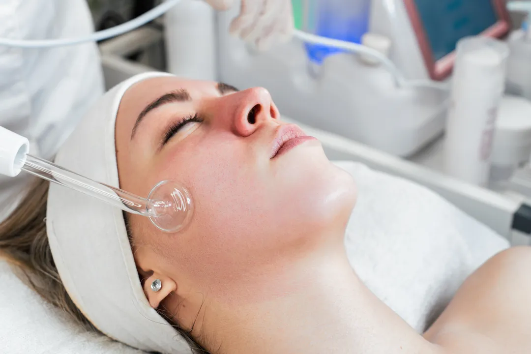 Effective Treatment Methods - Stop Ance - How to Get Rid of Forehead Acne: Simple Tips for Clear Skin - How to Prevent Forehead Acne - Simple Skincare Habits for Clear Skin - Palm