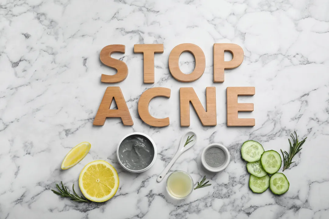 Natural Remedies for Forehead Acne - Stop Ance - How to Get Rid of Forehead Acne: Simple Tips for Clear Skin - How to Prevent Forehead Acne - Simple Skincare Habits for Clear Skin