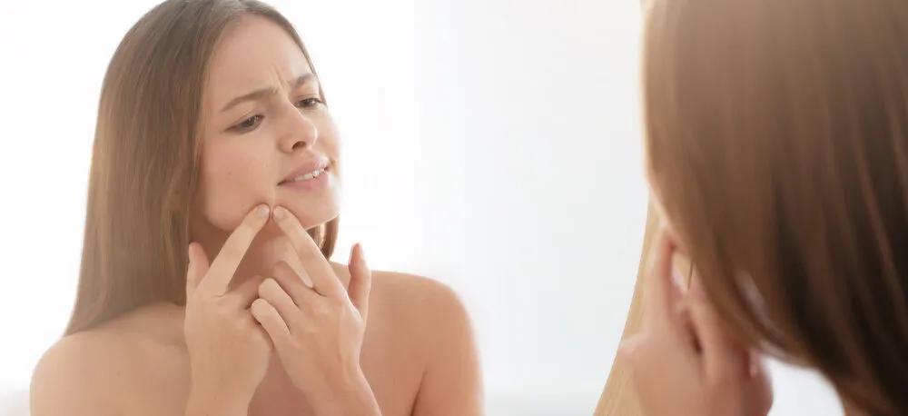 How to Get Rid of Whiteheads