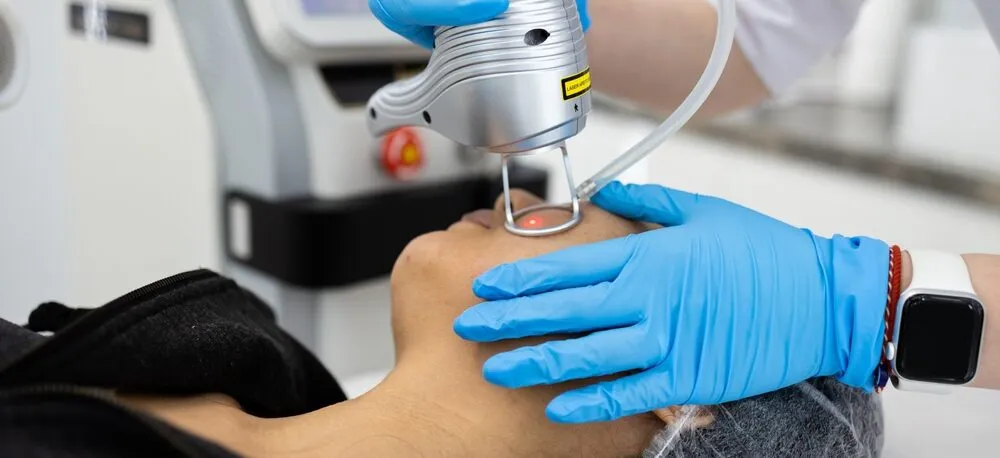 Unlocking Radiant Skin: Laser Treatment for Rosacea at Palm Beach Dermatology Group - Dermatology Clinic - PGA Dermatology Skin & Aesthetics Center