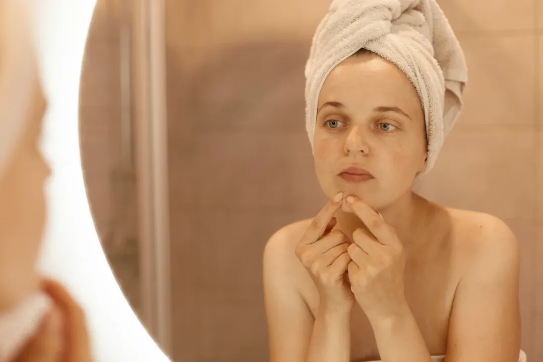 What Are Whiteheads? A Complete Guide to Causes and Treatments
