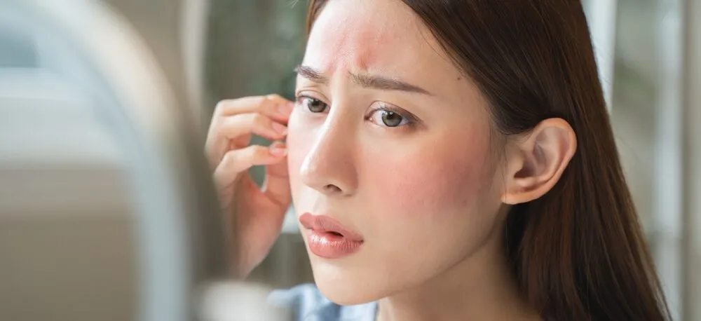 7 Answers to Why Is My Face Always Red? - Palm Beach Dermatology Group - Constant Facial Redness - Dermatology Clinic - Dermatology Consult - Skin Care Clinic - PGA Dermatology